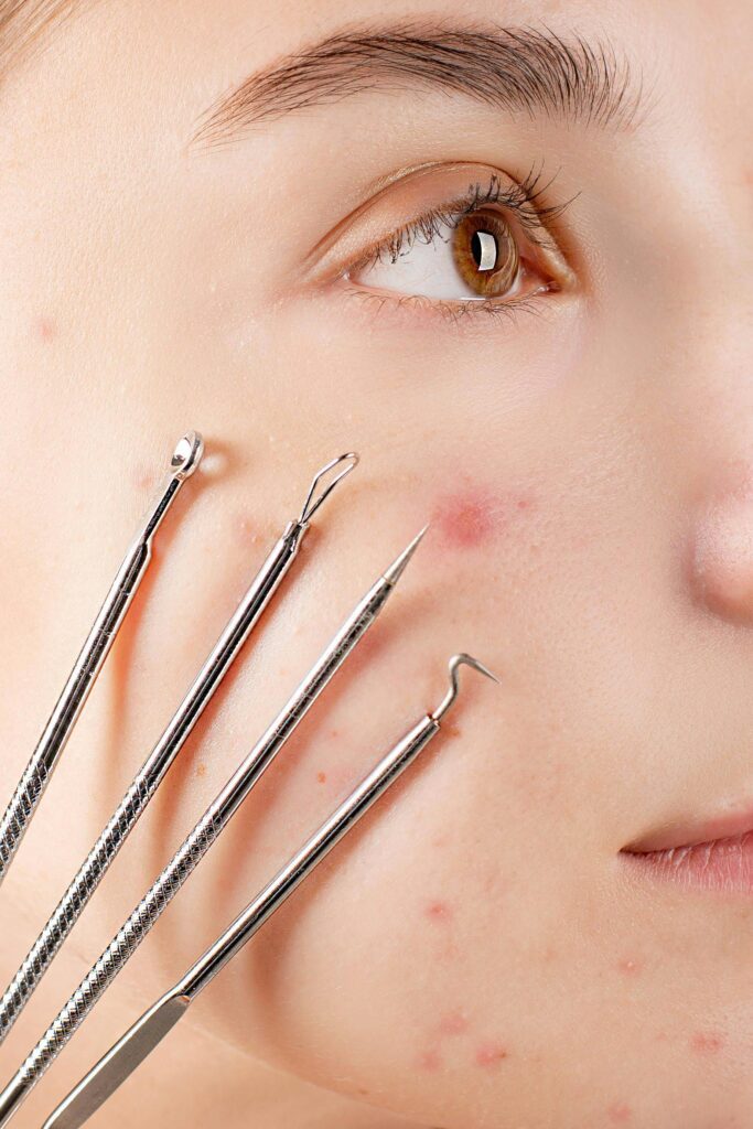 une peau avec des boutons